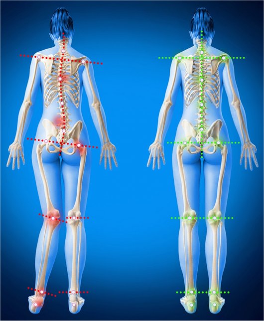 Trotteur et youpala : les dangers pour la posture – Seropp – Ostéopathie  Périnatale & Pédiatrique